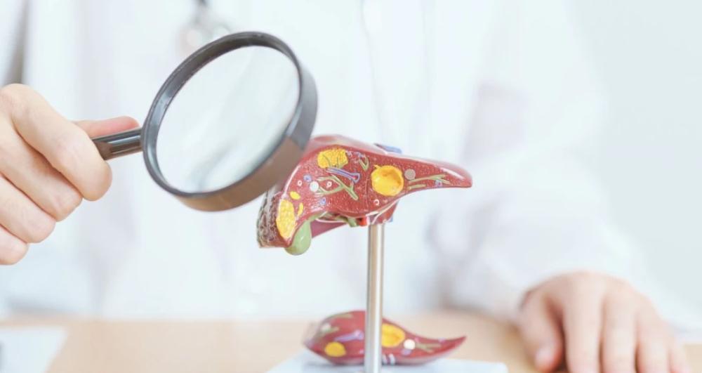 ГЕПАТИТЫ В и С: причины, симптомы, диагностика и лечение